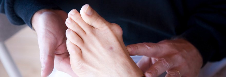 Hallux valgus